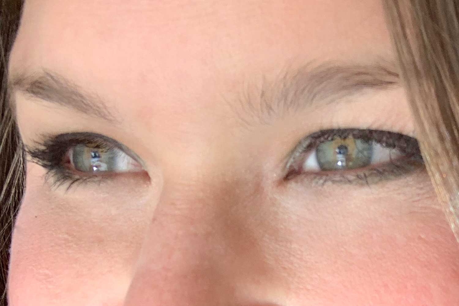 OJOS IRRITADOS Y ROJOS EN VERANO - ABÉÑULA NICOLICH