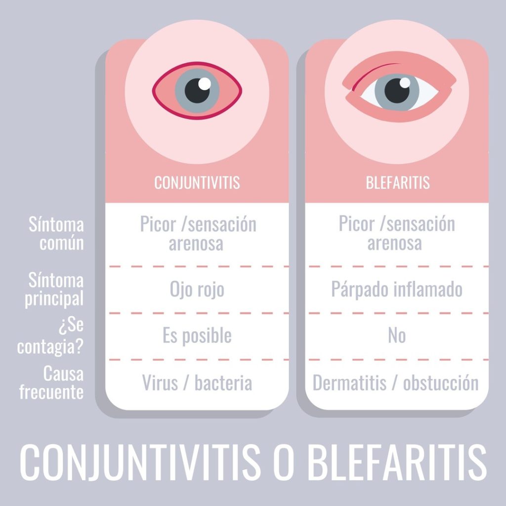 Gráfico de diferencias entre la conjuntivitis y la blefaritis